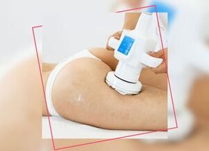 Masaj Transdermic cu Radiofrecventa
