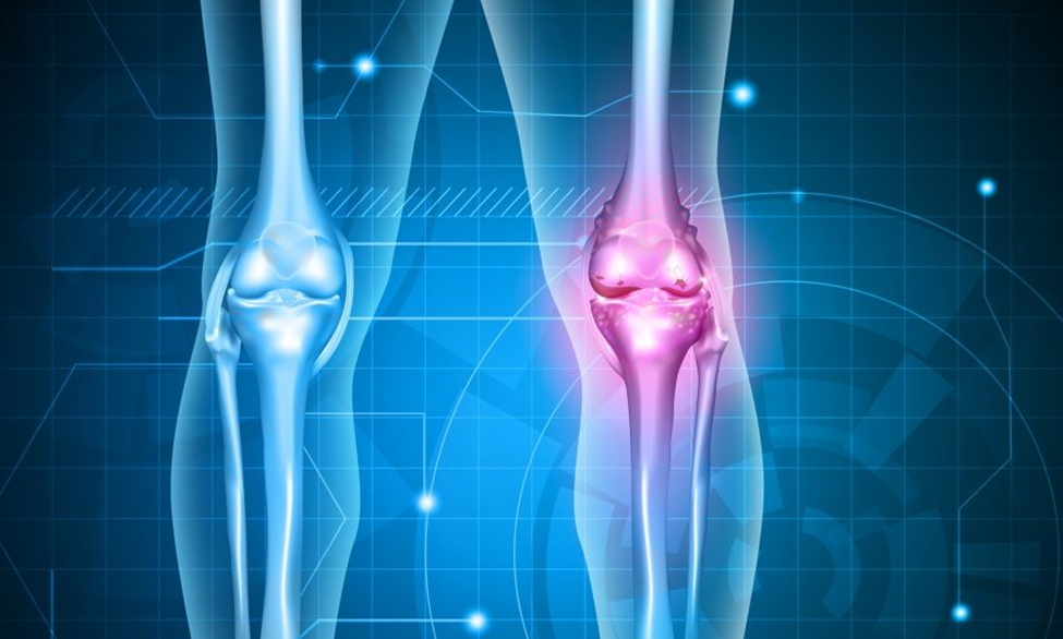 Beneficiile masajului terapeutic în gonartroza