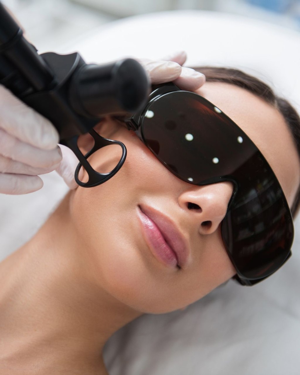 Rejuvenare facială cu laser 980 nm la Beauty Lines, Iași